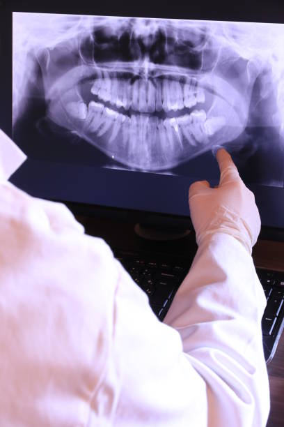 Best Chipped Tooth Repair Near Me  in Lockwood, MO